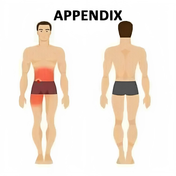appendix pain