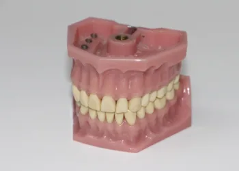 dentures 1514697 960 720.jpg