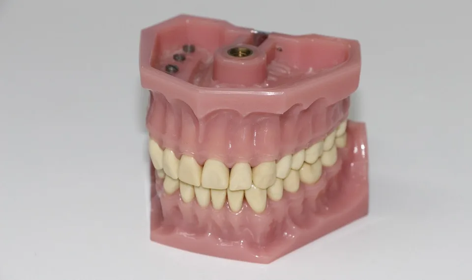 dentures 1514697 960 720.jpg