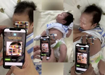 AI App Helps Parents Detect Infant Jaundice At Home