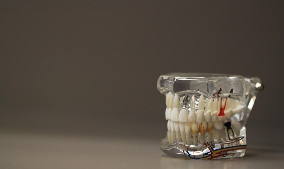 dentistry 668191 960 720.jpg