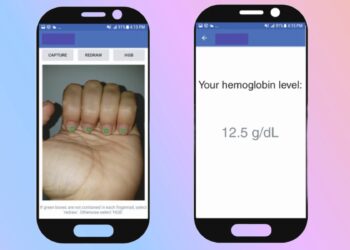 AI App Takes Nail Selfie to Spot Blood Condition Affecting Billions