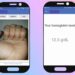 AI App Takes Nail Selfie to Spot Blood Condition Affecting Billions