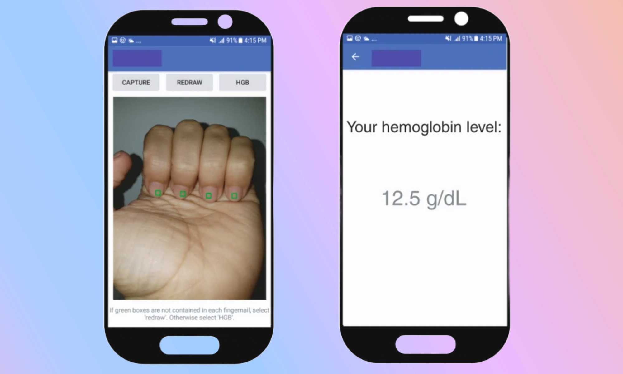 AI App Takes Nail Selfie to Spot Blood Condition Affecting Billions