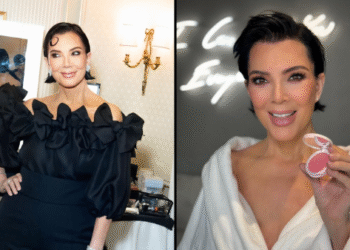 Kris Jenner Looks 30 Years Younger After Aesthetic Enhancements