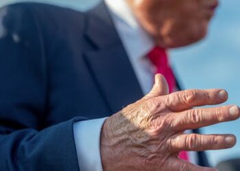 White House: Trump’s Bruised Hand and Swollen Leg Not Serious