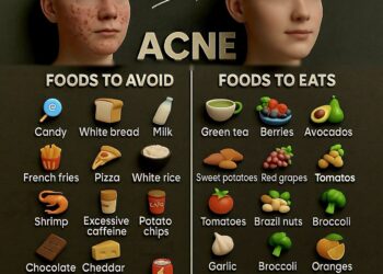 Best & Worst Foods for Acne 
What to Eat  & What to Avoid 

Foods to Avoid 

1.