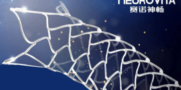 SinoMed Surges as FDA Grants Breakthrough Status to New Stent System