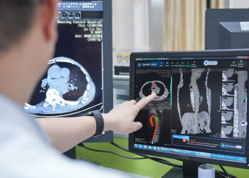 Alibaba & Tencent's Medical AI Revolution in Critical Care