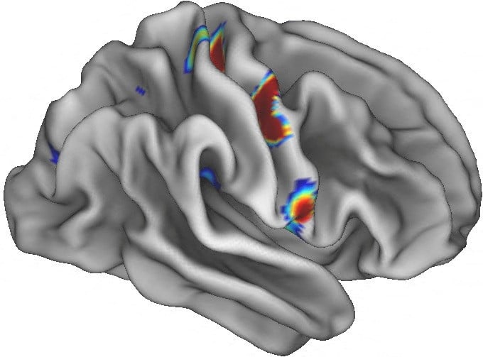 Illustration of movement areas in the brain with colored spots indicating connection points involved in thinking, planning, and regulating basic functions like heart rate.