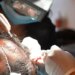 Dubai Police Bust Illegal Hair Transplant Clinic Thief