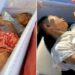 Thai woman discovered alive in coffin just before cremation