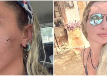 Turkish Actress Yildiz Asyalı Alleges Husband’s Violence