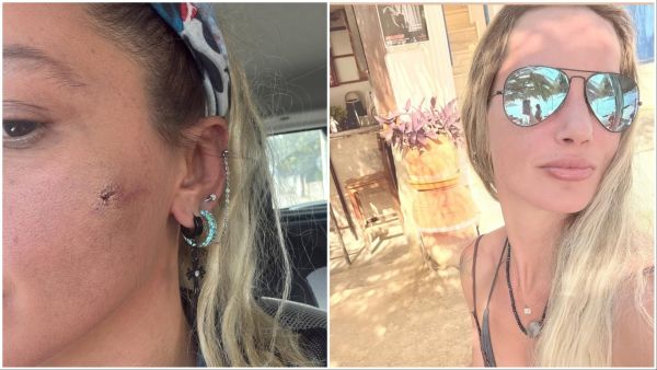 Turkish Actress Yildiz Asyalı Alleges Husband’s Violence