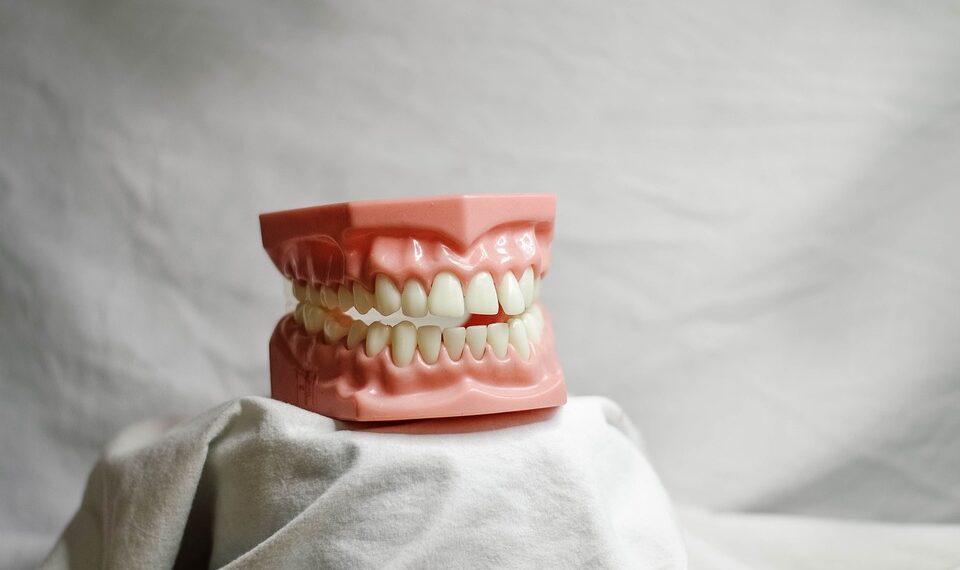 teeth 5522653 960 720.jpg