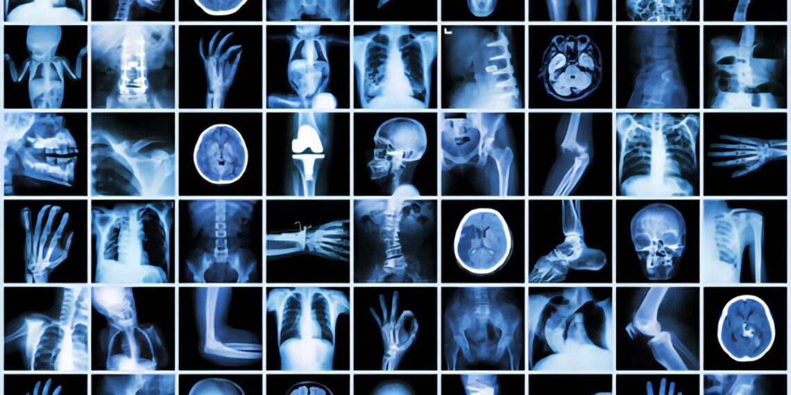 100 Accidental Inventions that Changed Human History

1.  Insulin – 1921
2.  Via