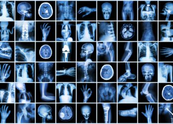 100 Accidental Inventions that Changed Human History

1.  Insulin – 1921
2.  Via