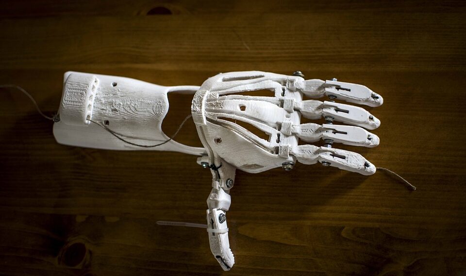 prostetic 1273183 960 720.jpg