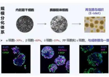 Chinese Team Transplants Stem Cell Islets to Tackle Diabetes Donor Shortage