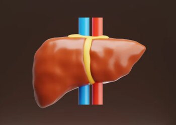Essential Facts About Fatty Liver Disease