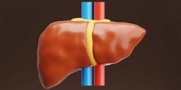 Essential Facts About Fatty Liver Disease