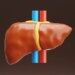 Essential Facts About Fatty Liver Disease