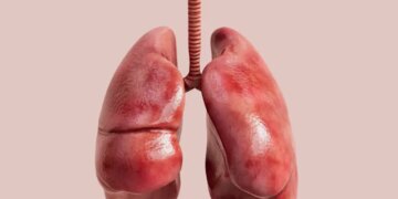 Man survives 48 hours without lungs thanks to breakthrough medical tech