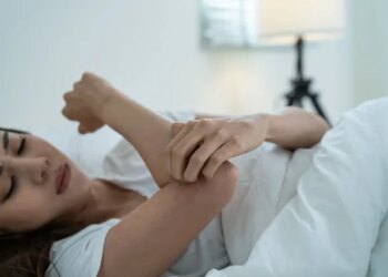 Mosquito-Borne Virus Leads to Years of Joint Pain