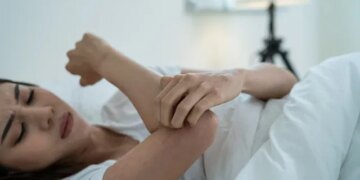 Mosquito-Borne Virus Leads to Years of Joint Pain