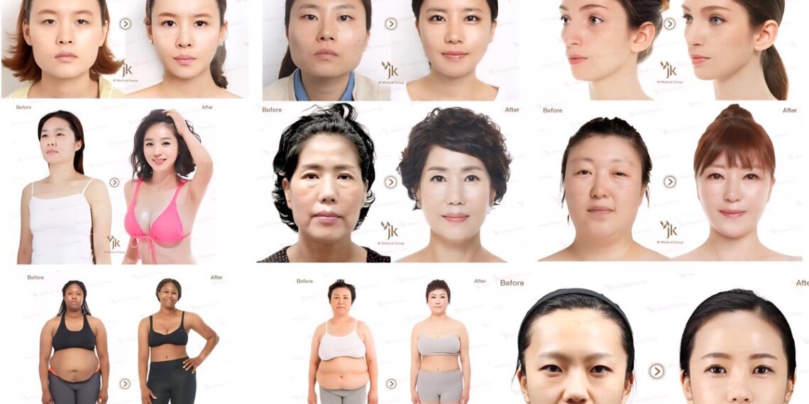 Top 50 Countries with the Highest Rates of Plastic Surgeries Per Capita

(Total