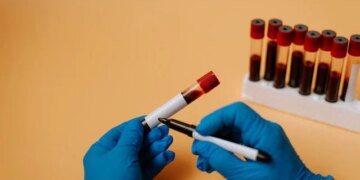 Detecting Cancer: A Tiny Drop, Big Diagnostics