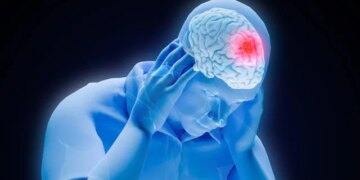 Early 72-Hour Post-Stroke Window Critically Influences Recovery