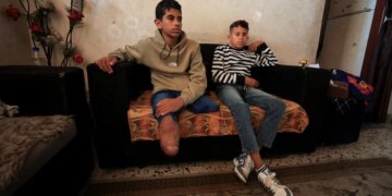 Gaza War Amputees Struggle for Prostheses Due to Israeli Limits