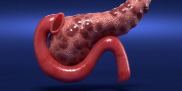 New Drug Offers Hope for Longer Pancreatic Cancer Survival