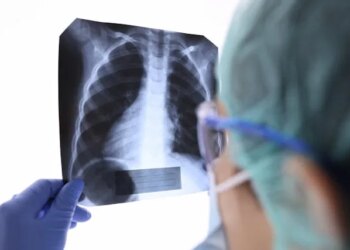 Researchers Discover New Method to Slow Breast Cancer Spread to Lungs