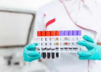 Younger Adults Face Rising Risk of Rectal Cancer, Study Reveals