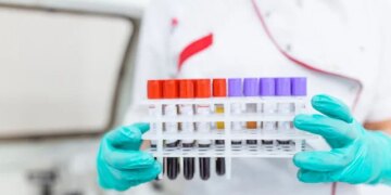 Younger Adults Face Rising Risk of Rectal Cancer, Study Reveals