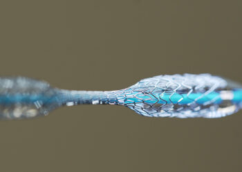 China’s Centralized Coronary Stent Procurement Reduces Patient Costs Without Compromising Outcomes