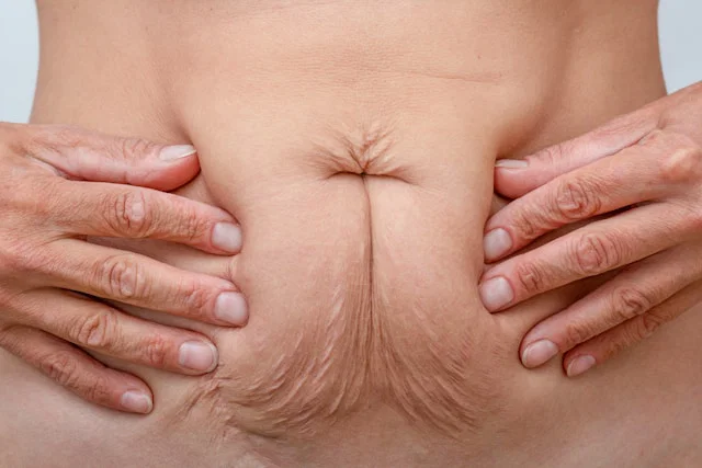 Hidden Nerve Damage from Obesity Across the Body