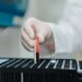 Most Americans Tested Have 'Forever Chemicals' in Their Blood