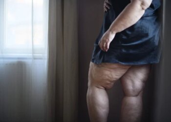 Rare Weight-Loss Drugs Might Help Halt Certain Cancers
